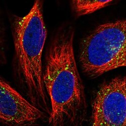 VPS35 Antibody, Novus Biologicals 0.1mL; Unlabeled:Antibodies, Polyclonal
