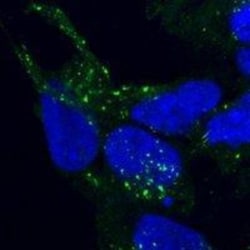 VPS35 Antibody, Novus Biologicals 0.1mg; Unlabeled:Antibodies, Polyclonal