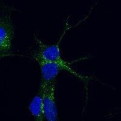 VPS35 Antibody, Novus Biologicals 0.1mg; Unlabeled:Antibodies, Polyclonal