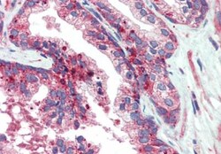 VPS35 Antibody, Novus Biologicals 0.1mg; Unlabeled:Antibodies, Polyclonal