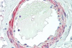 VPS35 Antibody, Novus Biologicals 0.1mg; Unlabeled:Antibodies, Polyclonal