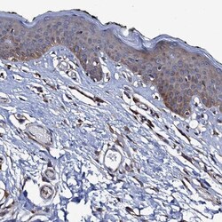 VPS35 Antibody, Novus Biologicals 0.1mL; Unlabeled:Antibodies, Polyclonal