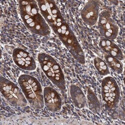 VPS35 Antibody, Novus Biologicals 0.1mL; Unlabeled:Antibodies, Polyclonal