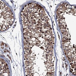 VPS35 Antibody, Novus Biologicals 0.1mL; Unlabeled:Antibodies, Polyclonal