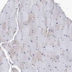 VPS35 Antibody, Novus Biologicals 0.1mL; Unlabeled:Antibodies, Polyclonal