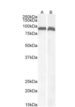 VPS35 Antibody, Novus Biologicals 0.1mg; Unlabeled:Antibodies, Polyclonal