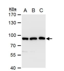 VPS35 Antibody, Novus Biologicals 0.1mL; Unlabeled:Antikroppar