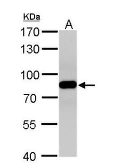 VPS35 Antibody, Novus Biologicals 0.1mL; Unlabeled:Antikroppar