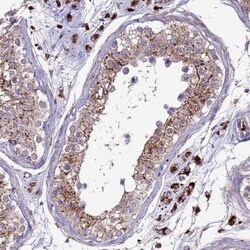 VPS36 Antibody, Novus Biologicals 0.1mL; Unlabeled:Antibodies, Polyclonal