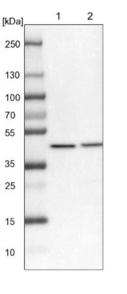 VPS36 Antibody, Novus Biologicals 0.1mL; Unlabeled:Antibodies, Polyclonal