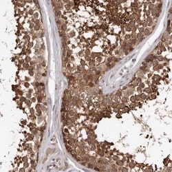 VPS37A Antibody, Novus Biologicals 0.1mL; Unlabeled:Antibodies, Polyclonal