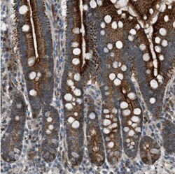 VPS41 Antibody, Novus Biologicals 0.1mL; Unlabeled:Antibodies, Polyclonal
