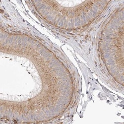 VPS45 Antibody, Novus Biologicals 0.1mL; Unlabeled:Antibodies, Polyclonal