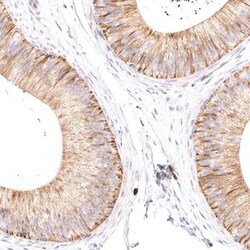 VPS45 Antibody, Novus Biologicals 0.1mL; Unlabeled:Antibodies, Polyclonal