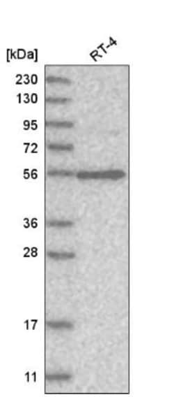 VPS45 Antibody, Novus Biologicals 0.1mL; Unlabeled:Antibodies, Polyclonal