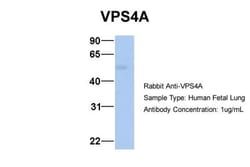 VPS4A Antibody, Novus Biologicals 0.05mg; Unlabeled:Antibodies, Polyclonal