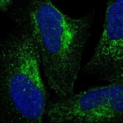 VPS53 Antibody, Novus Biologicals 25 &mu;L | Buy Online | Novus Biologicals | Fisher Scientific