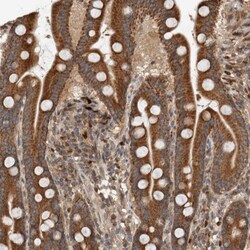 VPS53 Antibody, Novus Biologicals 25 &mu;L | Buy Online | Novus Biologicals | Fisher Scientific