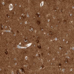 VPS53 Antibody, Novus Biologicals 25 &mu;L | Buy Online | Novus Biologicals | Fisher Scientific