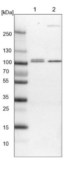 VPS53 Antibody, Novus Biologicals 25 &mu;L | Buy Online | Novus Biologicals | Fisher Scientific