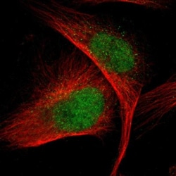 VRK1 Antibody, Novus Biologicals:Antibodies:Primary Antibodies