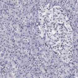 VRK1 Antibody, Novus Biologicals:Antibodies:Primary Antibodies