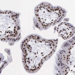 VRK1 Antibody, Novus Biologicals:Antibodies:Primary Antibodies