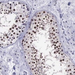VRK1 Antibody, Novus Biologicals:Antibodies:Primary Antibodies