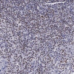 VRK1 Antibody, Novus Biologicals:Antibodies:Primary Antibodies