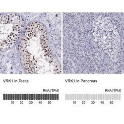 VRK1 Antibody, Novus Biologicals:Antibodies:Primary Antibodies
