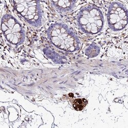 VRL1 Antibody, Novus Biologicals:Antibodies:Primary Antibodies