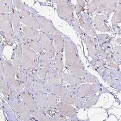 VRL1 Antibody, Novus Biologicals:Antibodies:Primary Antibodies