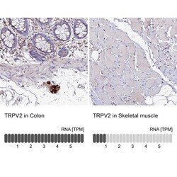 VRL1 Antibody, Novus Biologicals:Antibodies:Primary Antibodies