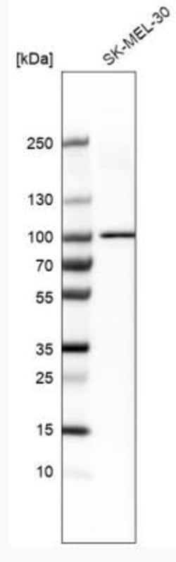 VRL1 Antibody, Novus Biologicals:Antibodies:Primary Antibodies
