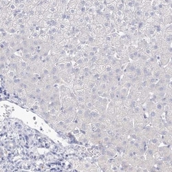 VSIG1 Antibody, Novus Biologicals 0.1mL; Unlabeled:Antibodies, Polyclonal