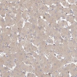 VSIG1 Antibody, Novus Biologicals 0.1mL; Unlabeled:Antibodies, Polyclonal