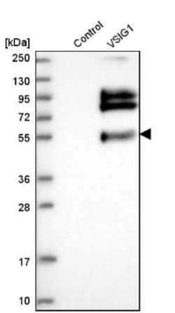 VSIG1 Antibody, Novus Biologicals 0.1mL; Unlabeled:Antibodies, Polyclonal