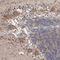 CTR2 Antibody, Novus Biologicals:Antibodies:Primary Antibodies