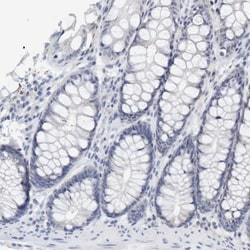 CTR2 Antibody, Novus Biologicals:Antibodies:Primary Antibodies