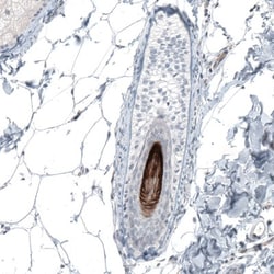 CTR2 Antibody, Novus Biologicals:Antibodies:Primary Antibodies