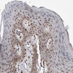 CTR2 Antibody, Novus Biologicals:Antibodies:Primary Antibodies