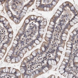 CTR2 Antibody, Novus Biologicals:Antibodies:Primary Antibodies