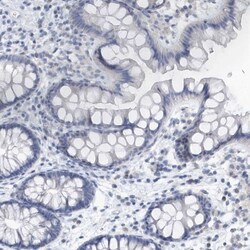 VWA5B2 Antibody, Novus Biologicals:Antibodies:Primary Antibodies