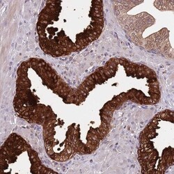 VWCE Antibody, Novus Biologicals:Antibodies:Primary Antibodies