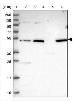 VWCE Antibody, Novus Biologicals:Antibodies:Primary Antibodies