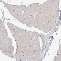 SELK Antibody, Novus Biologicals:Antibodies:Primary Antibodies