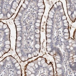 SELK Antibody, Novus Biologicals:Antibodies:Primary Antibodies