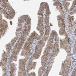 SELK Antibody, Novus Biologicals:Antibodies:Primary Antibodies