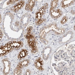 SELK Antibody, Novus Biologicals:Antibodies:Primary Antibodies