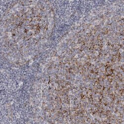 Vang-like Protein 2/VANGL2 Antibody, Novus Biologicals:Antibodies:Primary